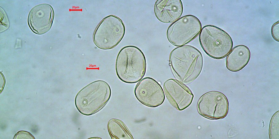 Mikroskopaufnahme von Weizenpollen.