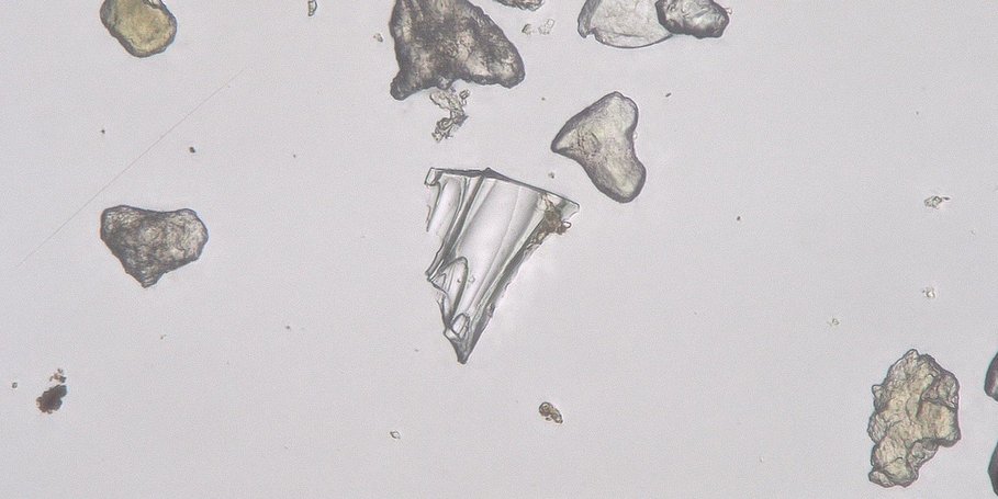 Foto (Bildzentrum) eines Kryptotephra-Partikels (mikroskopisch kleine Vulkanasche, Durchlichtmikroskopie) mit einem Durchmesser von ~60µm Durchmesser aus den Sedimenten des Toten Meeres, Israel.